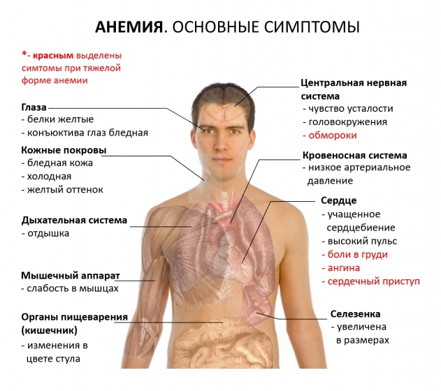 Анемия. Основные симптомы